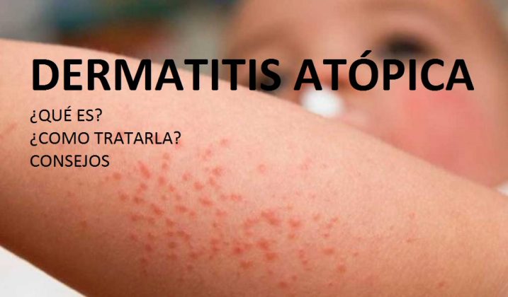 Dermatitis At Pica La Segunda Enfermedad M S Diagnosticada Del Mundo