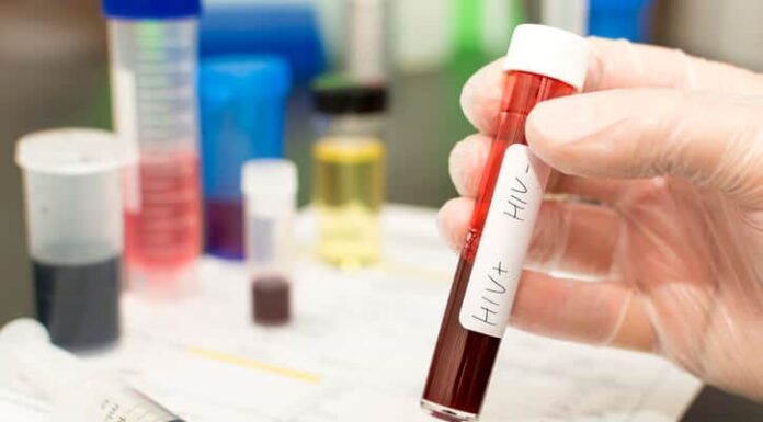 Salud lanza un nuevo punto de testeo rápido y asesoramiento sexual en Ushuaia