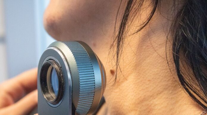 Implementan en Río Grande un programa pionero de prevención del cáncer de piel