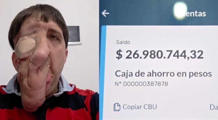 Solidaridad a toda prueba: Rubén Monsalve logró reunir lo necesario para su cirugía en tiempo récord