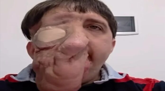 Rubén Monsalve tiene fecha confirmada: cirugía programada para el 9 de septiembre en Buenos Aires”